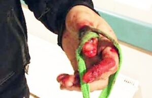 Dos jóvenes resultaron  heridos con arma blanca
