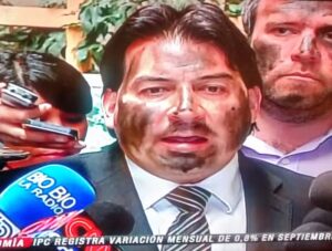 Con la cara manchada diputado denunció la contaminación en Quintero