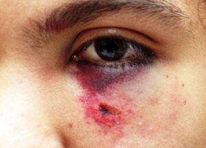 Madre denuncia violenta  golpiza a su hijo en liceo