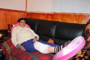 Mujer de 88 años fue atacada por perro calljero en la Villa Alfredo Lorca