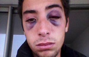 Joven viñamarino denunció por Facebook que su expolola le pegó
