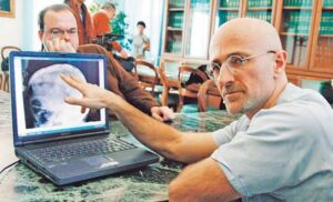 Primer trasplante de cabeza humana de la historia será posible en 2017