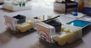Accesorio para celulares detecta sida y sífilis