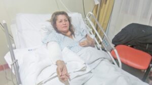 Trabajadora sufre graves secuelas tras quemadura en frigorífico