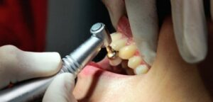 Dentistas y químicos farmacéuticos anuncian paro nacional para este martes