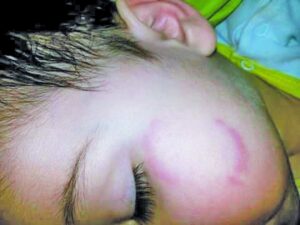 Madre denunció graves descuidos a su hijo en jardín infantil de Puerto Natales