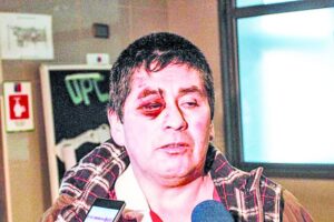 “A mi esposa le sacaron el ventilador mecánico pero no puede respirar sola”