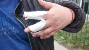Con un “diablito” jefe de hogar se defendió  de sujeto que robaba casa con cuchillo