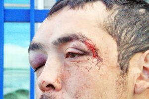Detenido denunció  en audiencia violenta  agresión de Carabineros