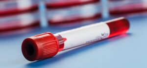 Ampliarían terapias a pacientes de VIH en nuevo decreto Auge/GES