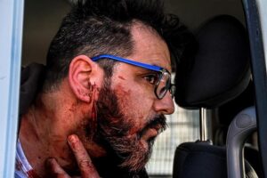 A los golpes y con un cuchillo terminó  altercado entre conductores