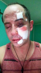 MOVILH comenta ataque a Natalino: