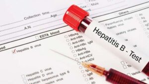 Seremi de Salud reforzó llamado sobre el autocuidado y prevención de la hepatitis