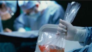 No es llegar y vender: los criterios que se  tienen en cuenta a la hora de donar un órgano