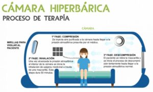 Cámara Hiperbárica y sus grandes beneficios a través de la terapia del oxígeno