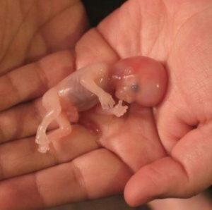 Puntarenenses dicen “NO” al aborto libre