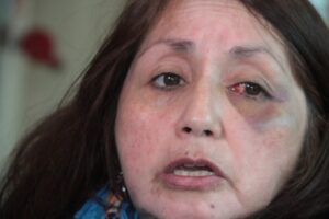 Cuidadora de anciano de 88 años fue violentamente agredida