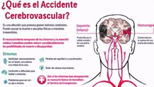 Geriatra aconseja cómo prevenir accidentes cerebrovasculares en la edad adulta