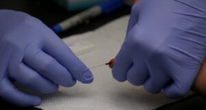 Minsal establece plazo de un año y medio para controlar cifras del VIH Sida en Chile