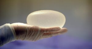 ISP anuncia retiro del mercado a popular implante mamario por riesgo de cáncer