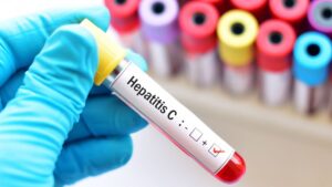 Preocupante cifra de hepatitis B en Magallanes: este año ya se han notificado 22 casos