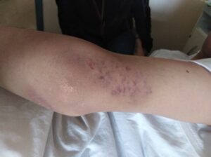Madre clama justicia por cobarde ataque a su hijo