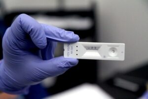 Empresas podrán solicitar test rápido de VIH: en 15 minutos se conoce el resultado