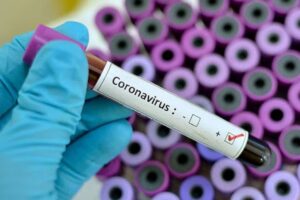 Ministerio de Salud ve con “optimismo” disminución de casos Covid-19 en Punta Arenas