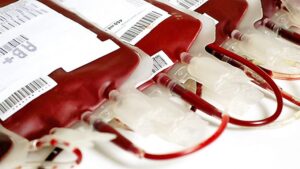 Plasma de personas recuperadas podrían erradicar el Covid-19 en pacientes enfermos