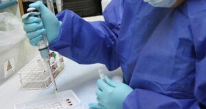 Minsal asegura disponibilidad de kits e insumos para diagnosticar COVID-19 en sistema público