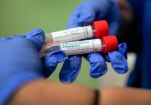 El anticuerpo para el coronavirus creado en Israel tiene nombre: Shalom Corona
