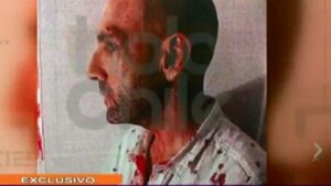 Revelan imágenes de Sergio Jadue ensangrentado tras supuesta pelea en Miami