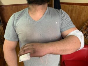 Vecino acusó que tras denunciar un intento de homicidio con un arma blanca su atacante fue dejado en libertad