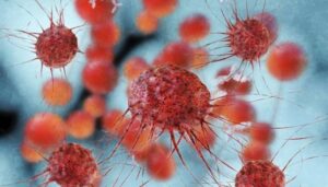 Desarrollan un análisis de sangre que podría detectar el cáncer años antes de que aparezcan los síntomas