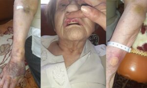 Denuncian maltrato hacia adulta mayor en el Hospital Clínico de Magallanes