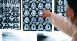 Investigación chilena muestra que ciertos alimentos podrían prevenir el Alzheimer