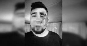 Carabineros abrió una investigación tras denuncia de joven natalino que acusó ser golpeado por tres policías