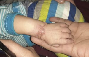 Madre que perdió un hijo por presunta negligencia denunció nuevo proceder médico erróneo con otro bebé