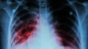 Informe de la OMS alerta que la pandemia ha 