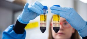 Farmacéuticas advierten escasez de materias primas para la fabricación de vacunas de coronavirus