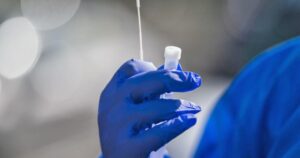 Una positividad del 15,1% se registró en Magallanes por el Covid-19