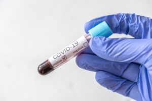 UMAG y UFRO investigan relación entre Covid-19 y enfermedades cardiovasculares