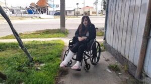 Mujer acusa grave error: le operaron pierna equivocada