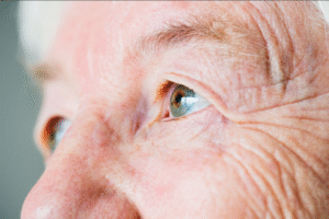 Glaucoma: la primera causa de ceguera irreversible en el mundo