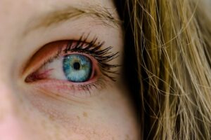 Oftalmólogo y cirugía refractiva:  “Es como tatuar un anteojo en el ojo”