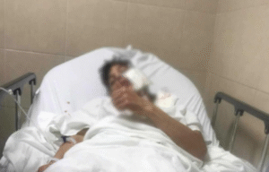Comenzó juicio contra joven que propinó machetazo en la cara a su víctima