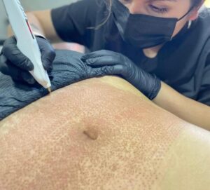 Vigilancia Sanitaria a Centros de Estética
