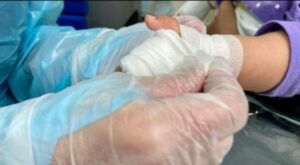 Alertan por alza de quemaduras en niños magallánicos