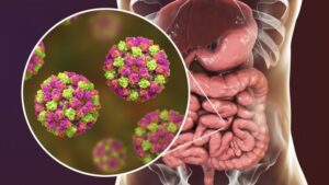 Salud alerta por casos de norovirus en Punta Arenas y Puerto Natales